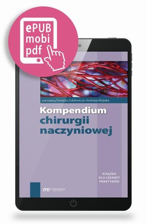 Kompendium chirurgii naczyniowej – ebook