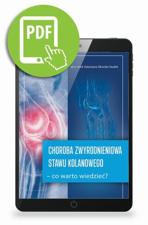 Choroba zwyrodnieniowa stawu kolanowego - co warto wiedzieć? – ebook