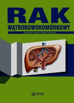Rak wątrobowokomórkowy – ebook