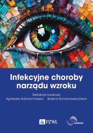 Infekcyjne choroby narządu wzroku &ndash; ebook