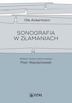 Sonografia w złamaniach &ndash; ebook