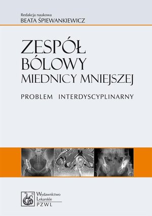 Zesp&oacute;ł b&oacute;lowy miednicy mniejszej. Problem interdyscyplinarny &ndash; ebook
