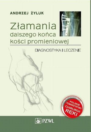 Złamania dalszego końca kości promieniowej: Diagnostyka i leczenie – ebook