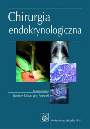 Chirurgia endokrynologiczna &ndash; ebook