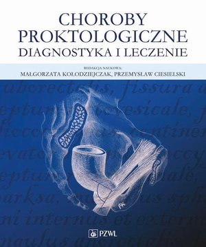 Choroby proktologiczne: Diagnostyka i leczenie &ndash; ebook