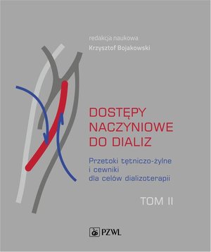 Dostępy naczyniowe do dializ. Tom 2: Przetoki tętniczo-żylne i cewniki dla cel&oacute;w dializoterapii &ndash; ebook
