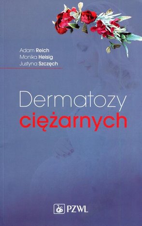 Dermatozy ciężarnych &ndash; ebook