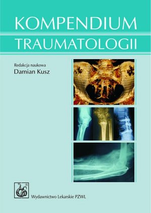 Kompendium traumatologii – ebook