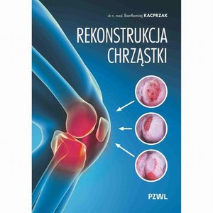Rekonstrukcja chrząstki: Ratujemy kolano, nie wymieniamy &ndash; ebook