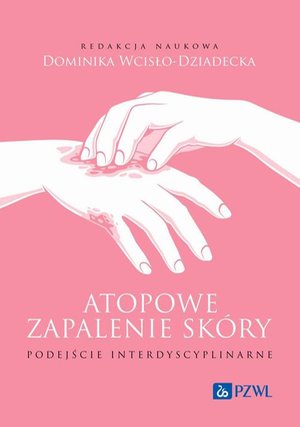 Atopowe zapalenie sk&oacute;ry Podejście interdyscyplinarne &ndash; ebook