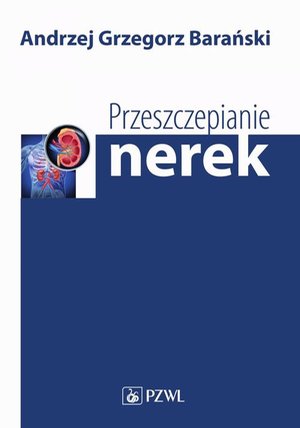 Przeszczepianie nerek &ndash; ebook