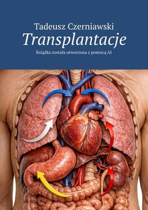 Transplantacje &ndash; ebook
