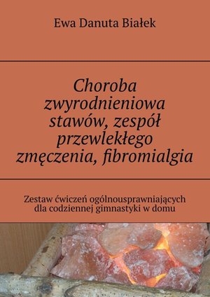 Choroba zwyrodnieniowa staw&oacute;w, zesp&oacute;ł przewlekłego zmęczenia, fibromialgia &ndash; ebook