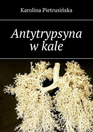 Antytrypsyna w kale – ebook
