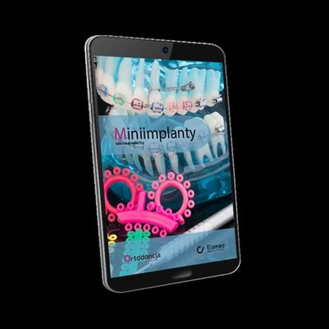 ebooki: Miniimplanty &ndash; ebook
