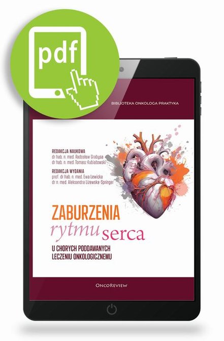 ebooki: Zaburzenia rytmu serca u chorych poddawanych leczeniu onkologicznemu &ndash; ebook