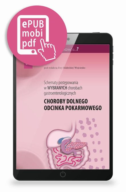 ebooki: Schematy postępowania w wybranych chorobach gastroenterologicznych: Choroby dolnego odcinka pokarmowego – ebook