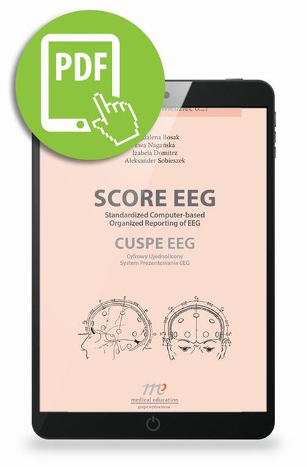 ebooki: SCORE EEG Standardized Computer-based Organized Reporting of EEG. CUSPE EEG Cyfrowy Ujednolicony System Prezentowania EEG &ndash; ebook