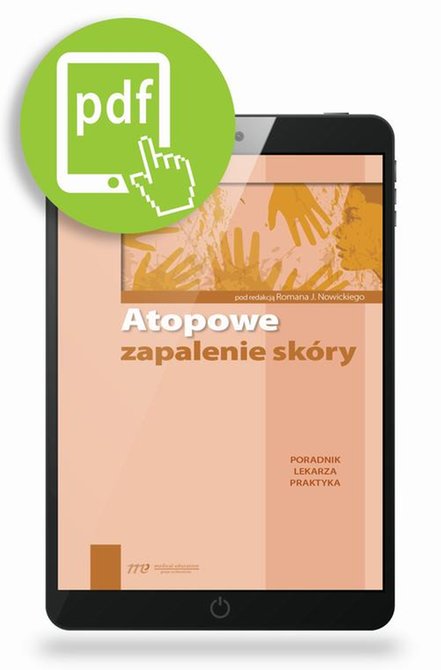 ebooki: Atopowe zapalenie sk&oacute;ry: Poradnik lekarza praktyka &ndash; ebook