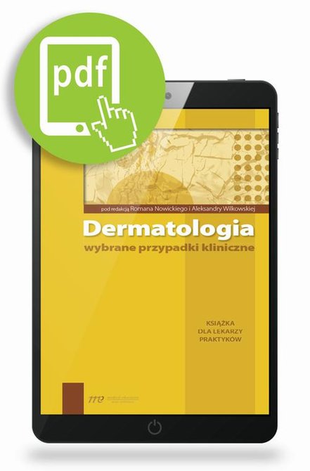 ebooki: Dermatologia - wybrane przypadki kliniczne &ndash; ebook
