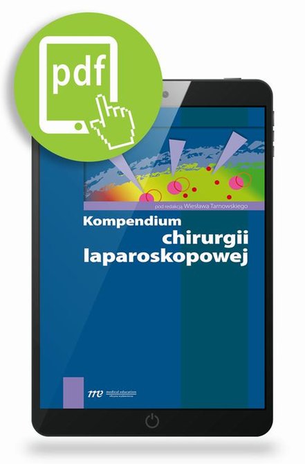 ebooki: Kompendium chirurgii laparoskopowej &ndash; ebook