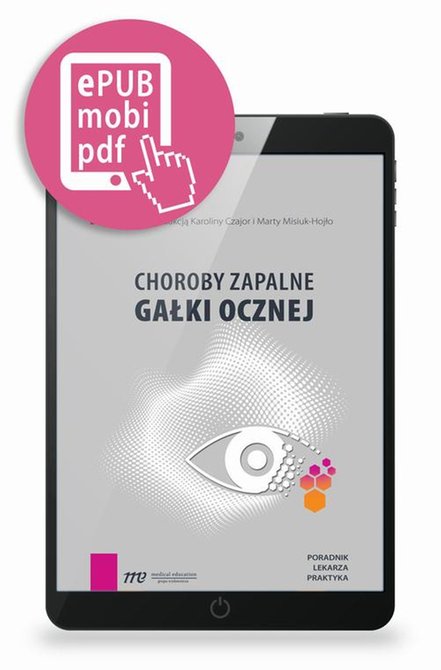 ebooki: Choroby zapalne gałki ocznej - poradnik lekarza praktyka &ndash; ebook