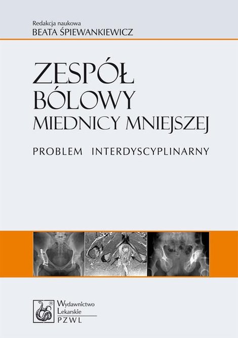 ebooki: Zesp&oacute;ł b&oacute;lowy miednicy mniejszej. Problem interdyscyplinarny &ndash; ebook