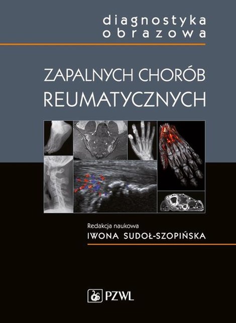 ebooki: Diagnostyka obrazowa zapalnych chor&oacute;b reumatycznych &ndash; ebook