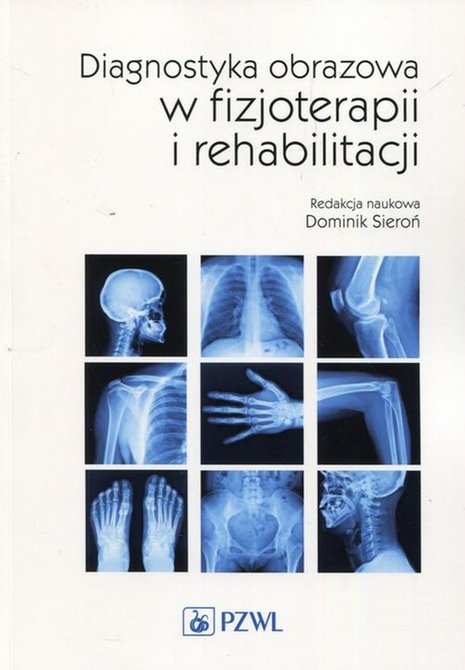 ebooki: Diagnostyka obrazowa w fizjoterapii i rehabilitacji &ndash; ebook