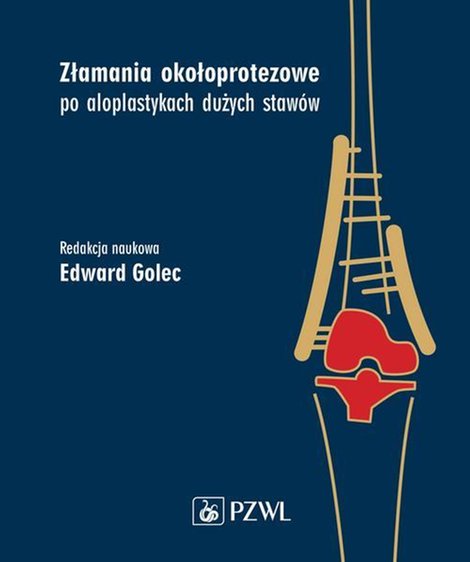 ebooki: Złamania okołoprotezowe po aloplastykach dużych staw&oacute;w &ndash; ebook