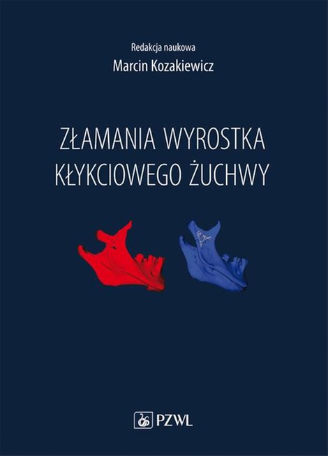 ebooki: Złamania wyrostka kłykciowego żuchwy &ndash; ebook