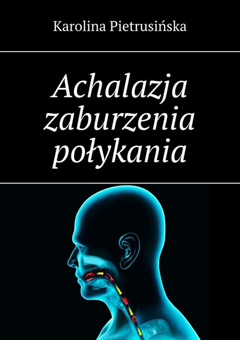 ebooki: Achalazja zaburzenia połykania &ndash; ebook
