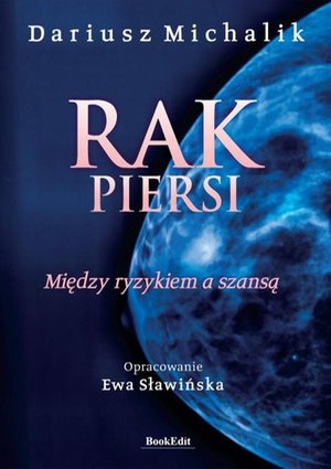 Rak piersi: Między ryzykiem a szansą – ebook