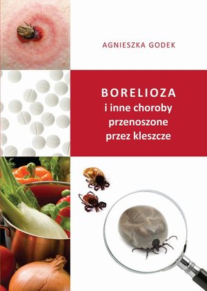 Borelioza i inne choroby przenoszone przez kleszcze – ebook