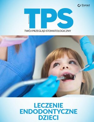 Leczenie endodontyczne dzieci – ebook