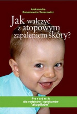 Jak walczyć z atopowym zapaleniem skóry: Poradnik dla rodziców atopików – ebook