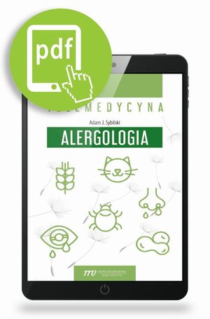 Telemedycyna. Alergologia – ebook