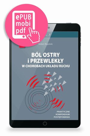 Ból ostry i przewlekły w chorobach układu ruchu – ebook