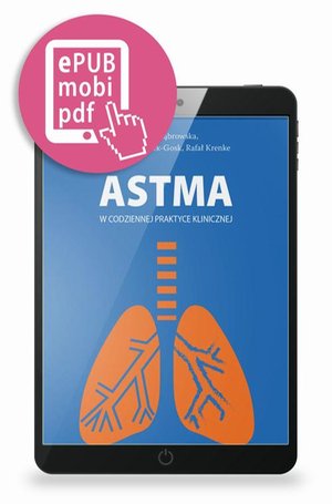 Astma w codziennej praktyce klinicznej – ebook