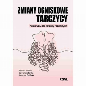 Medycyna: Zmiany ogniskowe tarczycy: Atlas USG dla lekarzy rodzinnych – ebook