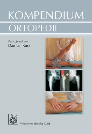 Kompendium ortopedii – ebook