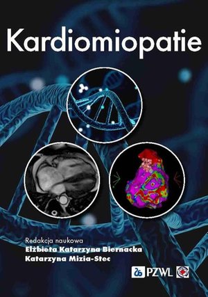 Kardiomiopatie – ebook