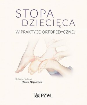 Stopa dziecięca w praktyce ortopedycznej – ebook