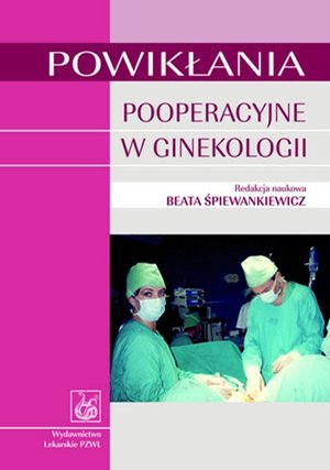 Powikłania pooperacyjne w ginekologii – ebook