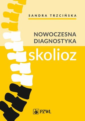 Nowoczesna diagnostyka skolioz – ebook