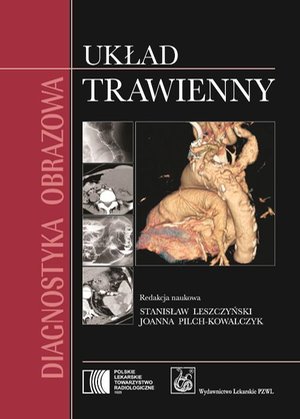 Diagnostyka obrazowa. Układ trawienny – ebook