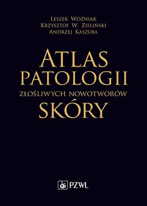 Atlas patologii złośliwych nowotworów skóry – ebook