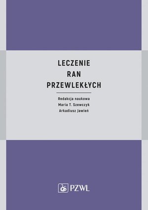 Leczenie ran przewlekłych – ebook