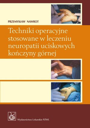 Techniki operacyjne stosowane w leczeniu neuropatii uciskowych kończyny górnej. – ebook