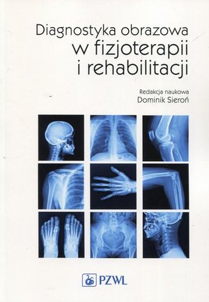 Diagnostyka obrazowa w fizjoterapii i rehabilitacji – ebook